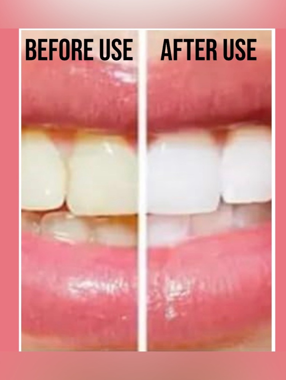 Set of TwoProbiotic Toothpaste SP 12 Toothpaste Ultra Whitening, Stain Removing